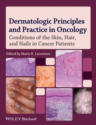 Dermatologic Principles and Practice in Oncology: Conditions of the Skin, Hair, and Nails in Cancer Patients - book cover