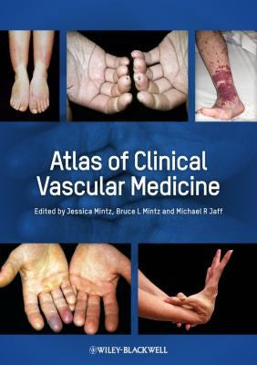 Atlas of Clinical Vascular Medicine - book cover