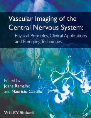 Vascular Imaging of the Central Nervous System: Physical Principles, Clinical Applications and Emerging Techniques - book cover