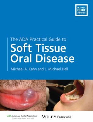 The ADA Practical Guide to Soft Tissue Oral Disease - book cover