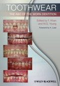 Toothwear: The ABC of the Worn Dentition - book cover