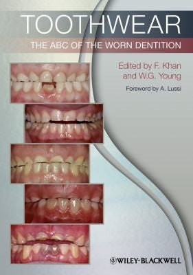 Toothwear: The ABC of the Worn Dentition - book cover