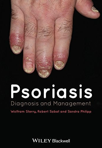 Psoriasis: Diagnosis and Management - book cover