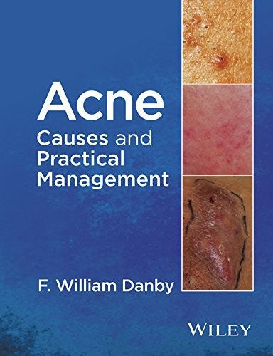Acne: Causes and Practical Management - book cover