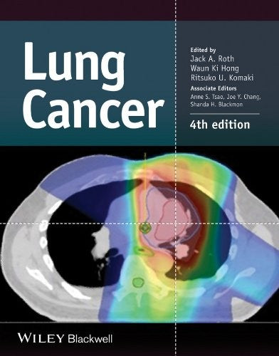 Lung Cancer - book cover