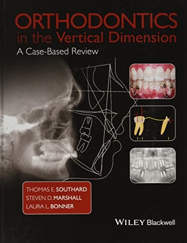 Orthodontics in the Vertical Dimension: A Case-Based Review - book cover