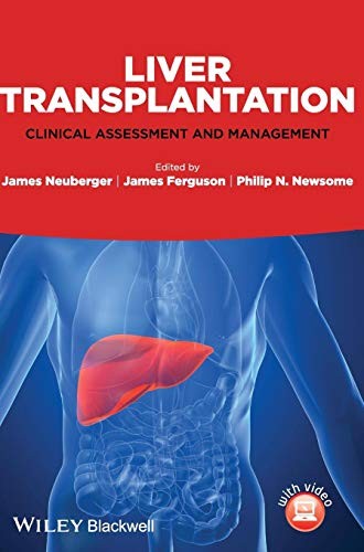 Liver Transplantation: Clinical Assessment and Management - book cover