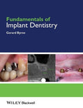 Fundamentals of Implant Dentistry - book cover
