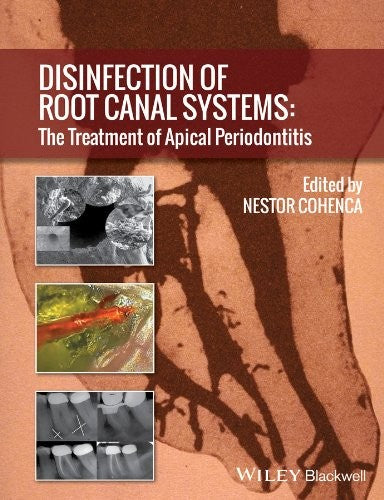Disinfection of root canal systems : the treatment of apical periodontitis - book cover