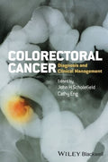 Colorectal Cancer: Diagnosis and Clinical Management - book cover