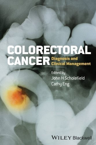 Colorectal Cancer: Diagnosis and Clinical Management - book cover