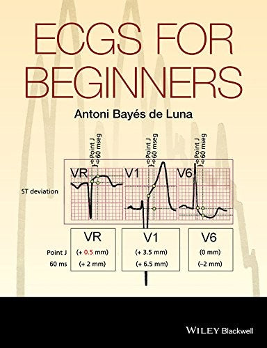 ECGs for Beginners - book cover