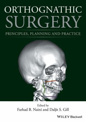Orthognathic Surgery: Principles, Planning and Practice - book cover