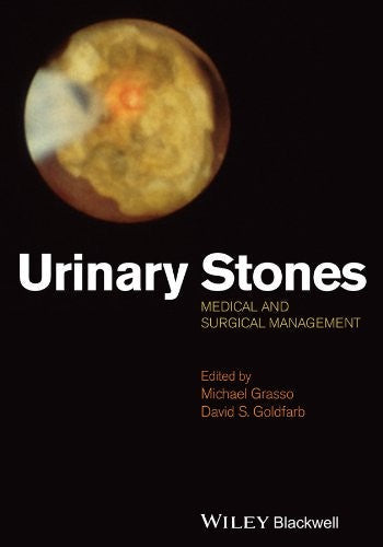 Urinary Stones: Medical and Surgical Management - book cover