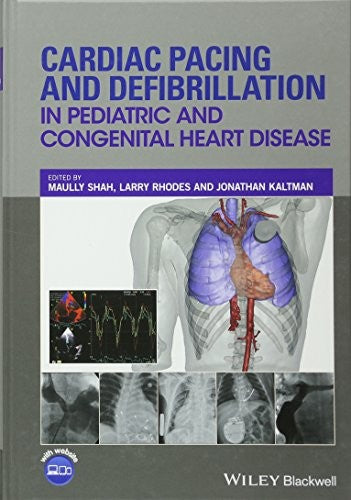 Cardiac Pacing and Defibrillation in Pediatric and Congenital Heart Disease - book cover