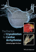 The Practice of Catheter Cryoablation for Cardiac Arrhythmias - book cover