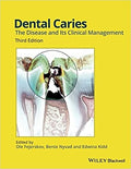 Dental Caries: The Disease and its Clinical Management - book cover