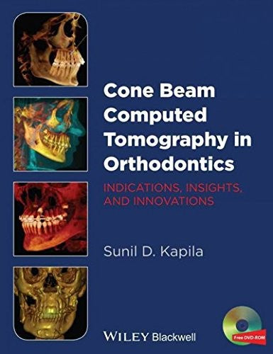 Cone Beam Computed Tomography in Orthodontics: Indications, Insights, and Innovations - book cover