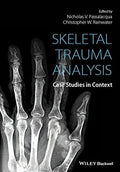 Skeletal Trauma Analysis: Case Studies in Context - book cover