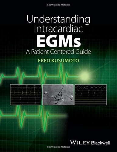 Understanding Intracardiac EGMs: A Patient Centered Guide - book cover