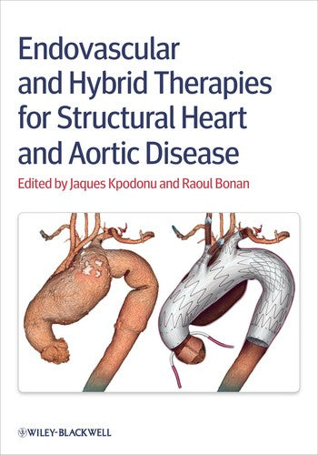 Endovascular and Hybrid Therapies for Structural Heart and Aortic Disease - book cover