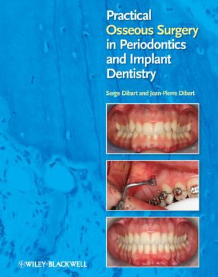 Practical Osseous Surgery in Periodontics and Implant Dentistry - book cover