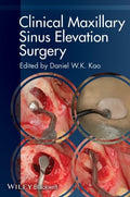 Clinical Maxillary Sinus Elevation Surgery - book cover