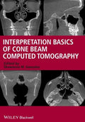 Interpretation basics of cone beam computed tomography - book cover
