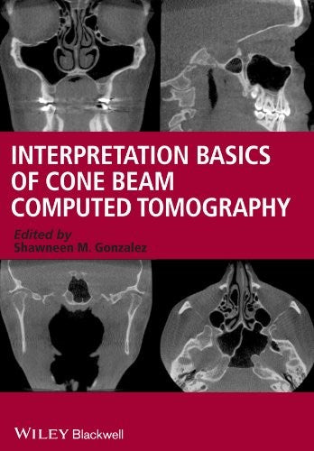 Interpretation basics of cone beam computed tomography - book cover