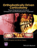 Orthodontically Driven Corticotomy: Tissue Engineering to Enhance Orthodontic and Multidisciplinary Treatment - book cover