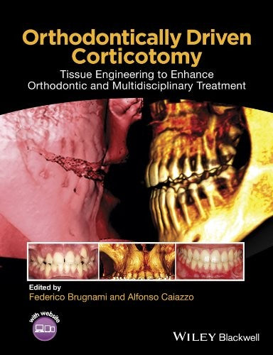 Orthodontically Driven Corticotomy: Tissue Engineering to Enhance Orthodontic and Multidisciplinary Treatment - book cover