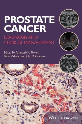 Prostate Cancer: Diagnosis and Clinical Management - book cover