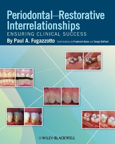 Periodontal-Restorative Interrelationships - book cover